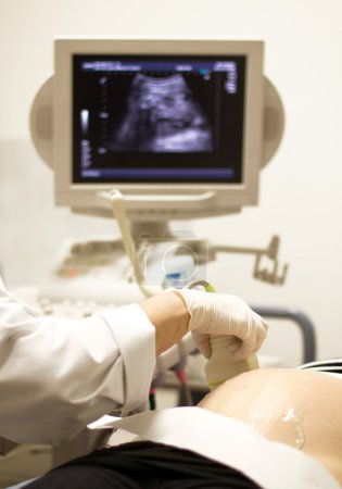 Medical examining pregnant belly by ultrasonic scan