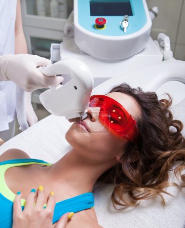 Woman getting face laser treatment
