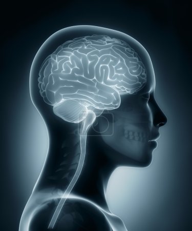 Female brain medical x-ray scan